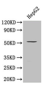 Western Blot | Positive WB detected in: HepG2 whole cell lysate | All lanes: SMAD9 antibody at 0.8μg/ml | Secondary | Goat polyclonal to rabbit IgG at 1/50000 dilution | Predicted band size: 53, 49 kDa | Observed band size: 53 kDaRabbit anti-Human SMAD9 Polyclonal Antibody
