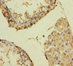Immunohistochemistry of paraffin-embedded human testis tissue using SMARCA2 Antibody at dilution of 1:100Rabbit anti-Human SMARCA2 Polyclonal Antibody