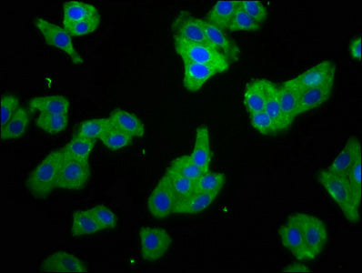Immunofluorescence staining of HepG2 cells with SMPD2 Antibody at 1:66, counter-stained with DAPI. The cells were fixed in 4% formaldehyde, permeabilized using 0.2% Triton X-100 and blocked in 10% normal Goat Serum. The cells were then incubated with the antibody overnight at 4°C. The secondary antibody was Alexa Fluor 488-congugated AffiniPure Goat Anti-Rabbit IgG(H+L).Rabbit anti-Human SMPD2 Polyclonal Antibody