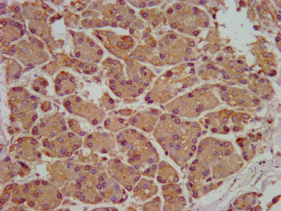 IHC image of SMPD2 Antibody diluted at 1:200 and staining in paraffin-embedded human pancreatic tissue performed on a Leica BondTM system. After dewaxing and hydration, antigen retrieval was mediated by high pressure in a citrate buffer (pH 6.0). Section was blocked with 10% normal goat serum 30min at RT. Then primary antibody (1% BSA) was incubated at 4°C overnight. The primary is detected by a biotinylated secondary antibody and visualized using an HRP conjugated SP system.Rabbit anti-Human SMPD2 Polyclonal Antibody