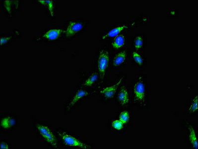 Immunofluorescent analysis of Hela cells using SMS Antibody at dilution of 1:100 and Alexa Fluor 488-congugated AffiniPure Goat Anti-Rabbit IgG(H+L)Rabbit anti-Human SMS Polyclonal Antibody