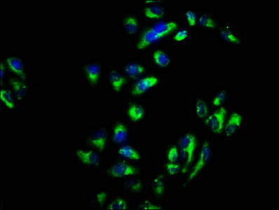 Immunofluorescence staining of Hela cells with SNAP23 Antibody at 1:66, counter-stained with DAPI. The cells were fixed in 4% formaldehyde, permeabilized using 0.2% Triton X-100 and blocked in 10% normal Goat Serum. The cells were then incubated with the antibody overnight at 4°C. The secondary antibody was Alexa Fluor 488-congugated AffiniPure Goat Anti-Rabbit IgG(H+L).Rabbit anti-Human SNAP23 Polyclonal Antibody