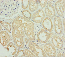 Immunohistochemistry of paraffin-embedded human kidney tissue using SNAP29 Antibody at dilution of 1:100Rabbit anti-Human SNAP29 Polyclonal Antibody