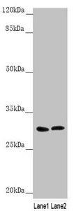Western blot  | All lanes: SNAP29 antibody at 1.79µg/ml  | Lane 1: 293T whole cell lysate  | Lane 2: Jurkat whole cell lysate  | Secondary  | Goat polyclonal to rabbit IgG at 1/10000 dilution  | Predicted band size: 29 kDa  | Observed band size: 29 kDaRabbit anti-Human SNAP29 Polyclonal Antibody