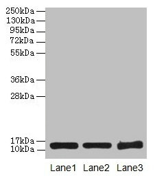 Western blot  | All lanes: SNCG antibody at 16µg/ml  | Lane 1: HT29 whole cell lysate  | Lane 2: Mouse brain tissue  | Lane 3: 293T whole cell lysate  | Secondary  | Goat polyclonal to rabbit IgG at 1/10000 dilution  | Predicted band size: 14 kDa  | Observed band size: 14 kDaRabbit anti-Human SNCG Polyclonal Antibody