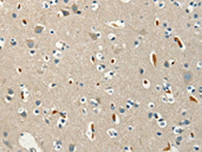 The image on the left is immunohistochemistry of paraffin-embedded Human brain  tissue using SERPINA9 Antibody(SERPINA9 Antibody) at dilution 1/60, on the right is treated with synthetic peptide. (Original magnification: ×200)Rabbit anti-Human SERPINA9 Polyclonal Antibody