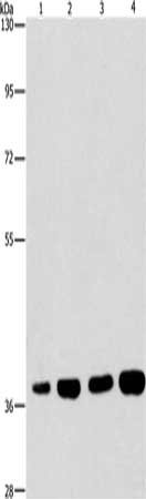 Gel: 8%SDS-PAGE, Lysate: 40 μg, Lane 1-4: 293T cells, 231 cells, U937 cells, Raji cells, Primary antibody: SERPINA9 Antibody(SERPINA9 Antibody) at dilution 1/337.5, Secondary antibody: Goat anti rabbit IgG at 1/8000 dilution, Exposure time: 10 secondsRabbit anti-Human SERPINA9 Polyclonal Antibody