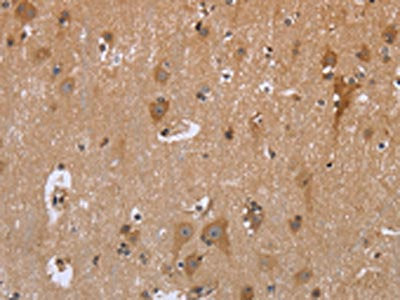 The image is immunohistochemistry of paraffin-embedded Human brain  tissue using GABPB2 Antibody(GABPB2 Antibody) at dilution 1/30. (Original magnification: ×200)Rabbit anti-Human GABPB2 Polyclonal Antibody
