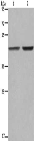 Gel: 8%SDS-PAGE, Lysate: 40 μg, Lane 1-2: MCF7 cells, 231 cells, Primary antibody: GABPB2 Antibody(GABPB2 Antibody) at dilution 1/550, Secondary antibody: Goat anti rabbit IgG at 1/8000 dilution, Exposure time: 1 minuteRabbit anti-Human GABPB2 Polyclonal Antibody