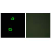 Immunofluorescence analysis of HepG2 cells, using LMTK2 antibody.