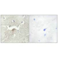 Immunohistochemistry analysis of paraffin-embedded human brain tissue using LMTK2 antibody.