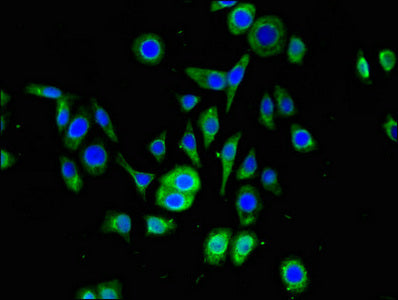 Immunofluorescent analysis of PC-3 cells using SNRPD1 Antibody at dilution of 1:100 and Alexa Fluor 488-congugated AffiniPure Goat Anti-Rabbit IgG(H+L)Rabbit anti-Human SNRPD1 Polyclonal Antibody