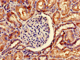 Immunohistochemistry of paraffin-embedded human kidney tissue using the antibody at dilution of 1:100Rabbit anti-Human SNRPD1 Polyclonal Antibody