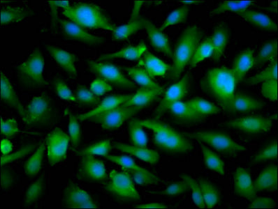 Immunofluorescence staining of U251 cells with SNRPE Antibody at 1:66, counter-stained with DAPI. The cells were fixed in 4% formaldehyde, permeabilized using 0.2% Triton X-100 and blocked in 10% normal Goat Serum. The cells were then incubated with the antibody overnight at 4°C. The secondary antibody was Alexa Fluor 488-congugated AffiniPure Goat Anti-Rabbit IgG(H+L).Rabbit anti-Human SNRPE Polyclonal Antibody