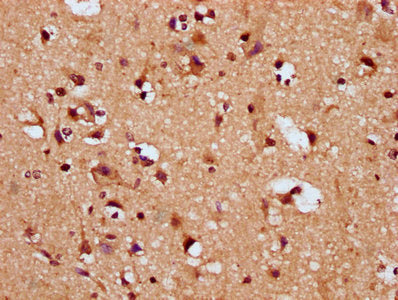 IHC image of SNRPE Antibody diluted at 1:200 and staining in paraffin-embedded human brain tissue performed on a Leica BondTM system. After dewaxing and hydration, antigen retrieval was mediated by high pressure in a citrate buffer (pH 6.0). Section was blocked with 10% normal goat serum 30min at RT. Then primary antibody (1% BSA) was incubated at 4°C overnight. The primary is detected by a biotinylated secondary antibody and visualized using an HRP conjugated SP system.Rabbit anti-Human SNRPE Polyclonal Antibody