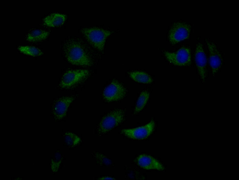 Immunofluorescence staining of A549 cell with SOAT1 Antibody at 1:50, counter-stained with DAPI. The cells were fixed in 4% formaldehyde, permeabilized using 0.2% Triton X-100 and blocked in 10% normal Goat Serum. The cells were then incubated with the antibody overnight at 4°C. The secondary antibody was Alexa Fluor 488-congugated AffiniPure Goat Anti-Rabbit IgG(H+L).Rabbit anti-Human SOAT1 Polyclonal Antibody