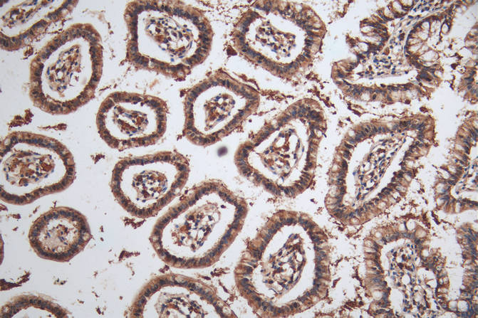 IHC image of SOAT1 Antibody diluted at 1:100 and staining in paraffin-embedded human small intestine tissue performed on a Leica BondTM system. After dewaxing and hydration, antigen retrieval was mediated by high pressure in a citrate buffer (pH 6.0). Section was blocked with 10% normal goat serum 30min at RT. Then primary antibody (1% BSA) was incubated at 4°C overnight. The primary is detected by a Goat anti-rabbit polymer IgG labeled by HRP and visualized using 0.05% DAB.Rabbit anti-Human SOAT1 Polyclonal Antibody
