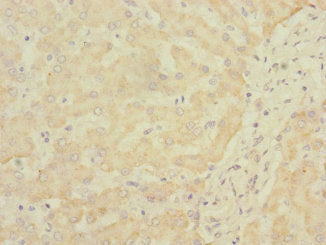 Immunohistochemistry of paraffin-embedded human liver tissue using SOAT2 Antibody at dilution of 1:100Rabbit anti-Human SOAT2 Polyclonal Antibody
