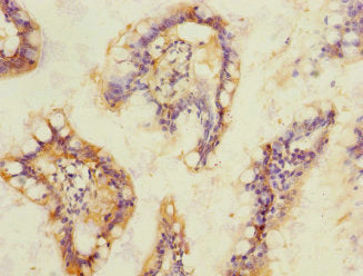 Immunohistochemistry of paraffin-embedded human small intestine tissue using SOAT2 Antibody at dilution of 1:100Rabbit anti-Human SOAT2 Polyclonal Antibody