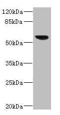 Western blot | All lanes: SOAT2 antibody IgG at 3.36μg/ml + 293T whole cell lysate | Secondary | Goat polyclonal to rabbit IgG at 1/10000 dilution | Predicted band size: 60, 58, 51, 35 kDa | Observed band size: 60 kDaRabbit anti-Human SOAT2 Polyclonal Antibody