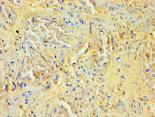 Immunohistochemistry of paraffin-embedded human lung tissue using SOCS2 Antibody at dilution of 1:100Rabbit anti-Human SOCS2 Polyclonal Antibody