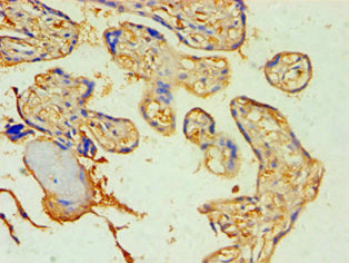 Immunohistochemistry of paraffin-embedded human placenta tissue using SOCS2 Antibody at dilution of 1:100Rabbit anti-Human SOCS2 Polyclonal Antibody