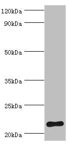 Western blot | All lanes: Suppressor of cytokine signaling 2 antibody at 2μg/ml + HepG2 whole cell lysate | Secondary | Goat polyclonal to rabbit IgG at 1/10000 dilution | Predicted band size: 22 kDa | Observed band size: 22 kDaRabbit anti-Human SOCS2 Polyclonal Antibody