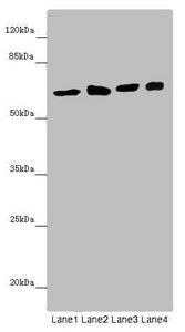 Western blot | All lanes: SOCS4 antibody at 4.39 μg/ml | Lane 1: Mouse kidney tissue | Lane 2: Jurkat whole cell lysate | Lane 3: A549 whole cell lysate | Lane 4: 293T whole cell lysate | Secondary | Goat polyclonal to rabbit IgG at 1/10000 dilution | Predicted band size: 60 kDa | Observed band size: 60 kDaRabbit anti-Human SOCS4 Polyclonal Antibody
