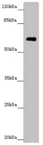 Western blot | All lanes: SOCS4 antibody at 4.25 μg/ml |  + Mouse kidney tissue | Secondary | Goat polyclonal to rabbit IgG at 1/10000 dilution | Predicted band size: 60 kDa | Observed band size: 60 kDaRabbit anti-Human SOCS4 Polyclonal Antibody