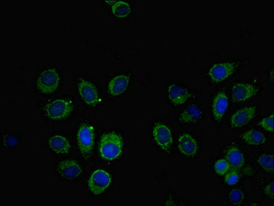 Immunofluorescent analysis of A549 cells using SOCS6 Antibody at dilution of 1:100 and Alexa Fluor 488-congugated AffiniPure Goat Anti-Rabbit IgG(H+L)Rabbit anti-Human SOCS6 Polyclonal Antibody