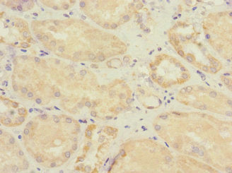 Immunohistochemistry of paraffin-embedded human kidney tissue using the antibody at dilution of 1:100Rabbit anti-Human SOCS6 Polyclonal Antibody