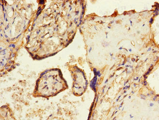 Immunohistochemistry of paraffin-embedded human placenta tissue using SOCS6 Antibody at dilution of 1:100Rabbit anti-Human SOCS6 Polyclonal Antibody