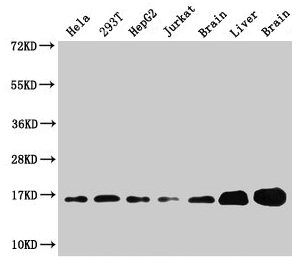 Western Blot  | Positive WB detected in: Hela whole cell lysate, 293T whole cell lysate, HepG2 whole cell lysate, Jurkat whole cell lysate, Rat brain tissue, Rat liver tissue, Mouse brain tissue  | All lanes: Sod1 antibody at 3µg/ml  | Secondary  | Goat polyclonal to rabbit IgG at 1/50000 dilution  | Predicted band size: 16 kDa  | Observed band size: 16 kDaRabbit anti-Mus musculus (Mouse) Sod1 Polyclonal Antibody