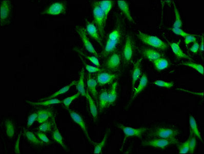 Immunofluorescence staining of Hela cells with SOD2 Antibody at 1:250, counter-stained with DAPI. The cells were fixed in 4% formaldehyde, permeabilized using 0.2% Triton X-100 and blocked in 10% normal Goat Serum. The cells were then incubated with the antibody overnight at 4°C. The secondary antibody was Alexa Fluor 488-congugated AffiniPure Goat Anti-Rabbit IgG(H+L).Rabbit anti-Human SOD2 Polyclonal Antibody