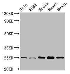 Western Blot  | Positive WB detected in: Hela whole cell lysate, K562 whole cell lysate, Rat brain tissue, Rat heart tissue, Mouse brain tissu  | All lanes: SOD2 antibody at 3.4µg/ml  | Secondary  | Goat polyclonal to rabbit IgG at 1/50000 dilution  | Predicted band size: 25, 21, 19, 20 kDa  | Observed band size: 25 kDaRabbit anti-Human SOD2 Polyclonal Antibody