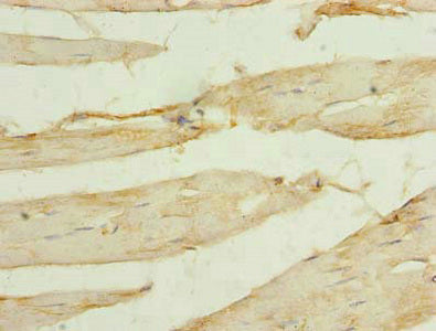 Immunohistochemistry of paraffin-embedded human skeletal muscle tissue using SORBS3 Antibody at dilution of 1:100Rabbit anti-Human SORBS3 Polyclonal Antibody