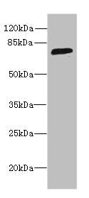 Western blot  | All lanes: SORBS3 antibody at 8µg/ml + HepG2 whole cell lysate  | Secondary  | Goat polyclonal to rabbit IgG at 1/10000 dilution  | Predicted band size: 76, 37 kDa  | Observed band size: 76 kDaRabbit anti-Human SORBS3 Polyclonal Antibody