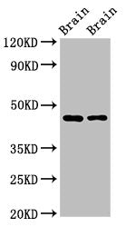 Western Blot | Positive WB detected in: Rat brain tissue, Mouse brain tissue | All lanes: SOX11 antibody at 2.7μg/ml | Secondary | Goat polyclonal to rabbit IgG at 1/50000 dilution | Predicted band size: 47 kDa | Observed band size: 47 kDaRabbit anti-Human SOX11 Polyclonal Antibody