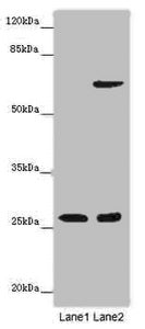 Western blot | All lanes: SOX14 antibody at 14μg/ml | Lane 1: Human placenta tissue | Lane 2: HepG2 whole cell lysate | Secondary | Goat polyclonal to rabbit IgG at 1/10000 dilution | Predicted band size: 27 kDa | Observed band size: 27 kDaRabbit anti-Human SOX14 Polyclonal Antibody