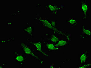 Immunofluorescent analysis of U251 cells using SOX9 Antibody at dilution of 1:100 and Alexa Fluor 488-congugated AffiniPure Goat Anti-Rabbit IgG(H+L)Rabbit anti-Human SOX9 Polyclonal Antibody