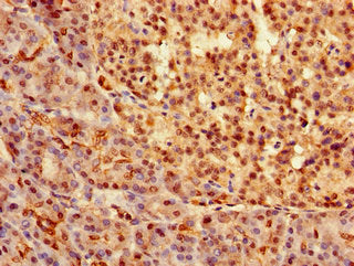 Immunohistochemistry of paraffin-embedded human pancreatic tissue using SOX9 Antibody at dilution of 1:100Rabbit anti-Human SOX9 Polyclonal Antibody