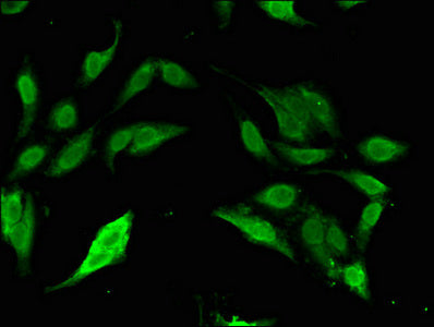 Immunofluorescent analysis of Hela cells using SP110 Antibody at dilution of 1:100 and Alexa Fluor 488-congugated AffiniPure Goat Anti-Rabbit IgG(H+L)Rabbit anti-Human SP110 Polyclonal Antibody