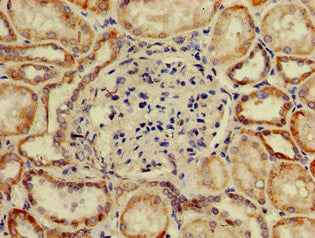 Immunohistochemistry of paraffin-embedded human kidney tissue using SP110 Antibody at dilution of 1:100Rabbit anti-Human SP110 Polyclonal Antibody