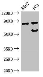 Western Blot | Positive WB detected in: K562 whole cell lysate, PC-3 whole cell lysate | All lanes: SP110 antibody at 2.7μg/ml | Secondary | Goat polyclonal to rabbit IgG at 1/50000 dilution | Predicted band size: 79, 47, 62, 29, 82, 63 kDa | Observed band size: 79, 64 kDaRabbit anti-Human SP110 Polyclonal Antibody