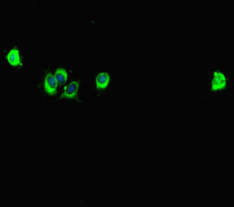 Immunofluorescent analysis of Hela cells using SPAG9 Antibody at dilution of 1:100 and Alexa Fluor 488-congugated AffiniPure Goat Anti-Rabbit IgG(H+L)