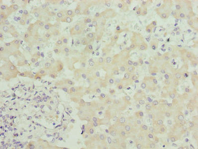 Immunohistochemistry of paraffin-embedded human liver tissue using the antibody at dilution of 1:100Rabbit anti-Human SPCS3 Polyclonal Antibody