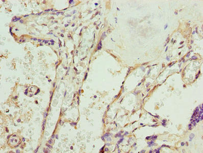 Immunohistochemistry of paraffin-embedded human placenta tissue using SPCS3 Antibody at dilution of 1:100Rabbit anti-Human SPCS3 Polyclonal Antibody