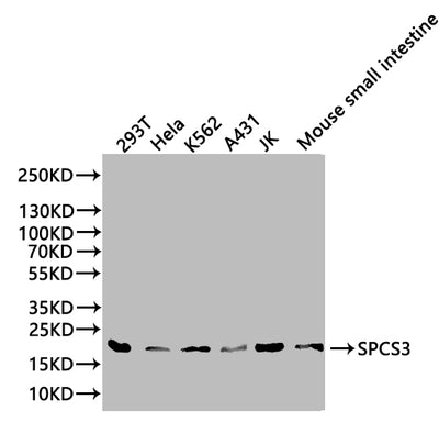 Western blot  | All lanes: SPCS3 antibody at 0.1µg/ml + Mouse kidney tissue  | Secondary  | Goat polyclonal to rabbit at 1/10000 dilution  | Predicted band size: 21 kDa  | Observed band size: 21 kDaRabbit anti-Human SPCS3 Polyclonal Antibody