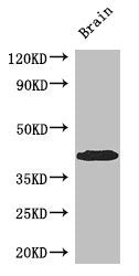 Western Blot | Positive WB detected in: Mouse brain tissue | All lanes: SPDEF antibody at 3μg/ml | Secondary | Goat polyclonal to rabbit IgG at 1/50000 dilution | Predicted band size: 38, 36 kDa | Observed band size: 38 kDaRabbit anti-Human SPDEF Polyclonal Antibody