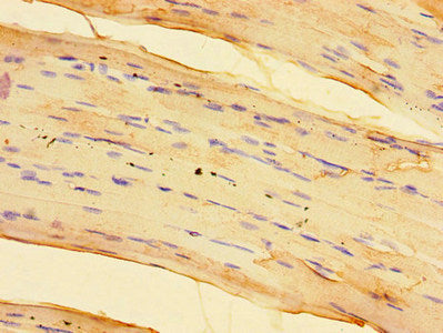 Immunohistochemistry of paraffin-embedded human skeletal muscle tissue using SPHK1 Antibody at dilution of 1:100Rabbit anti-Human SPHK1 Polyclonal Antibody